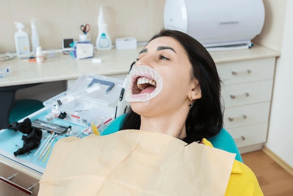 What Are Dental Crowns and How Can They Restore Your Smile in Beaumont, TX